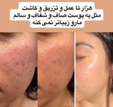 دوره درمانی ضدجوش